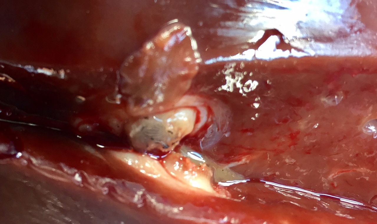 Revealed: Which county has the worst liver fluke record