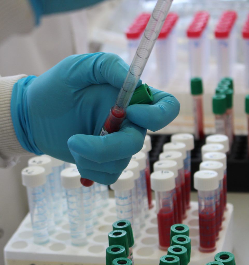 TB steering group meets with CVO to explore eradication policies