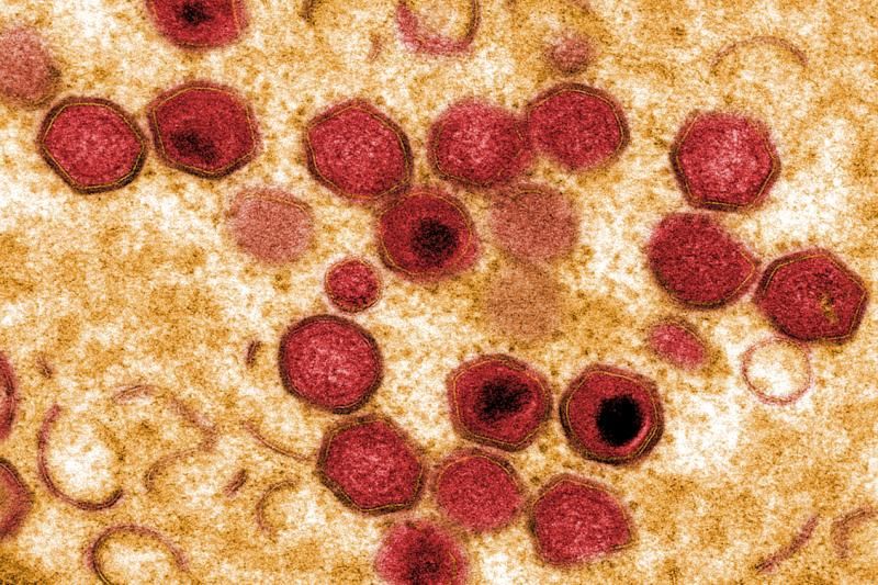 Study finds Pirbright African swine fever vaccine has 100% success rate