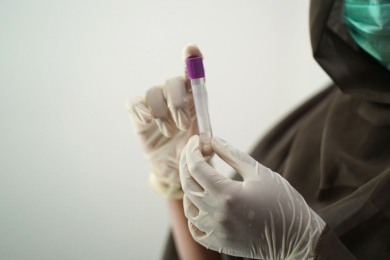 Teagasc's role in fighting Covid-19: Samples, sequencing and making sense of the situation