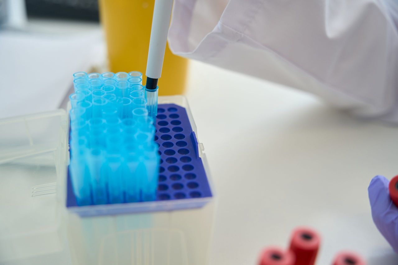 DAFM: 19,000 'samples of ruminants' tested for bluetongue this year