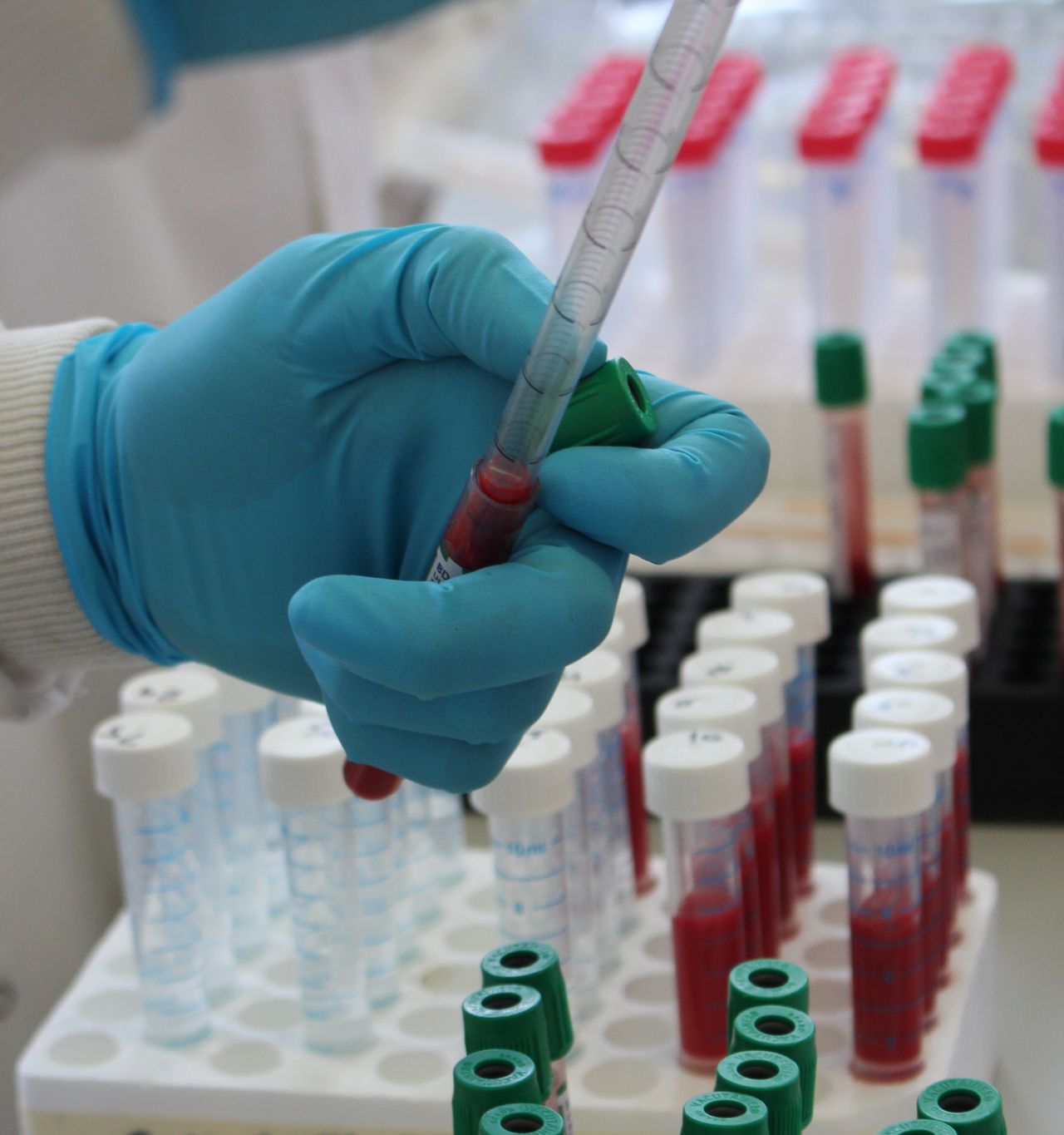 Treasury refuses to replace £15.3 million EU TB fund for Northern Ireland