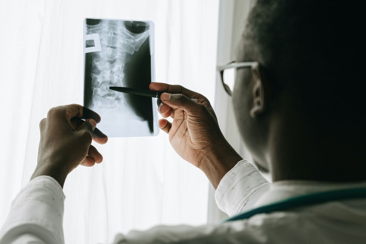Vegans at higher risk of bone fractures - Oxford study