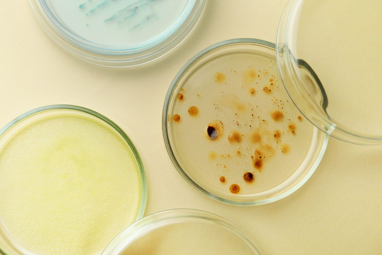 Guidance note on control of listeria issued for food businesses