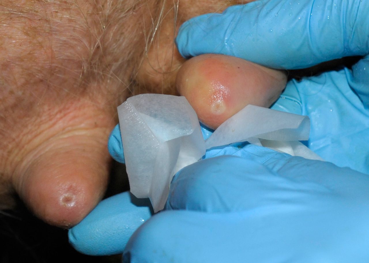 Are antibiotics masking poor drying off techniques?