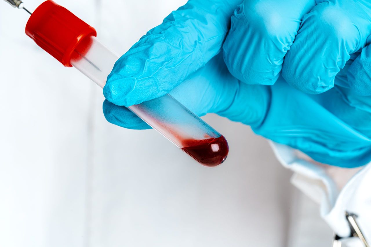 DAFM data shows more TB reactors identified in Cork than any other county